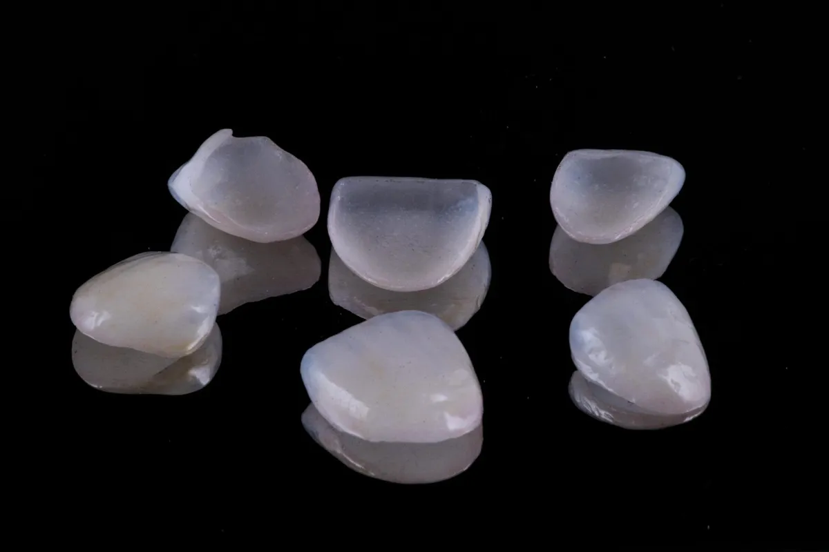 Vollkeramische Veneers — natürliche Ästhetik