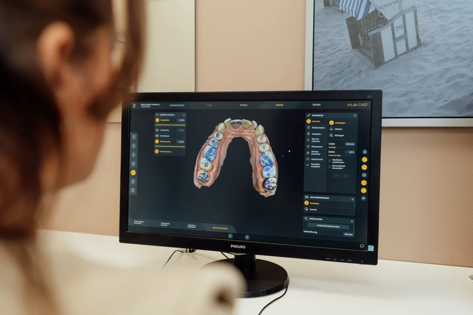 Digitales CAD-Design der vollkeramischen Krone in der Praxis